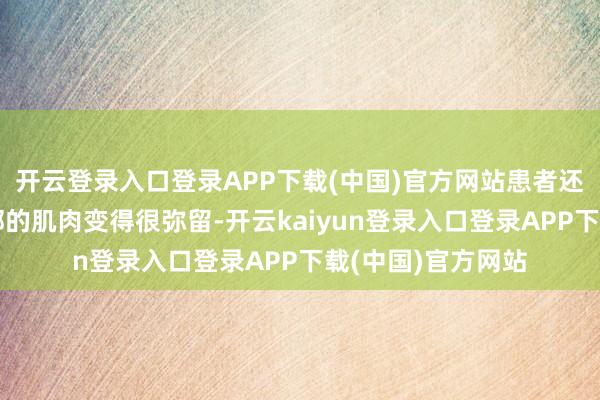 开云登录入口登录APP下载(中国)官方网站患者还能领悟嗅觉到颈部的肌肉变得很弥留-开云kaiyun登录入口登录APP下载(中国)官方网站